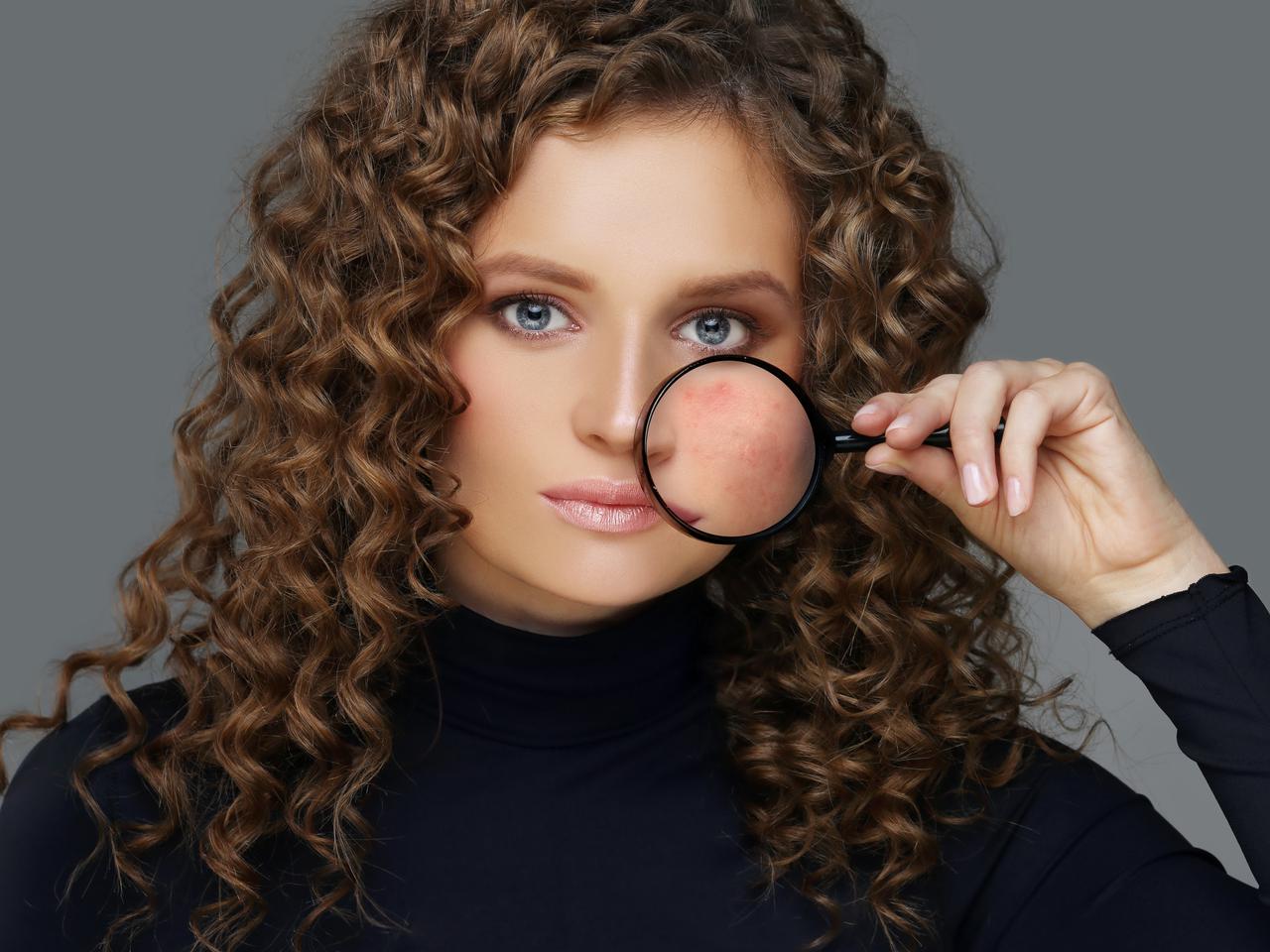 透明感を底上げ!肌の赤み&にきび跡を抑える原因別アイテム2選