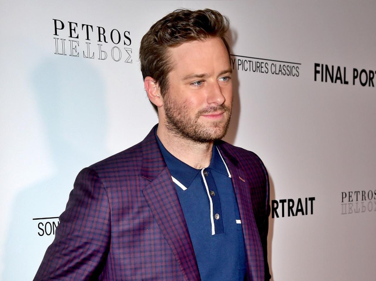 アーミー・ハマー、相次ぐスキャンダルで「すでに撮影済みの作品」はどうなる？