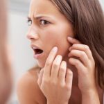 「ノンコメドジェニック」って何？ニキビが気になる肌のための選び方