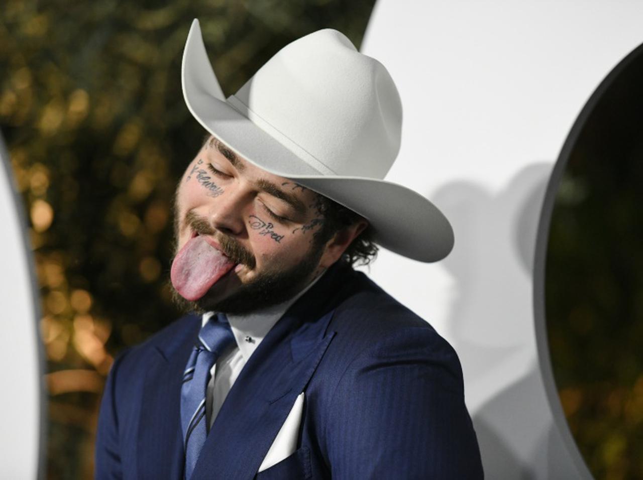 ポスト・マローン、約1億7,000万円をかけて「笑顔」をアップグレード