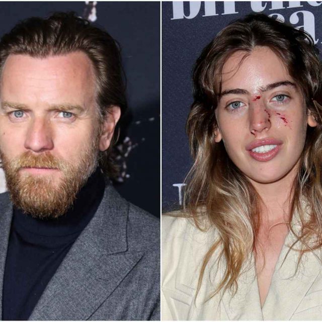 ユアン・マクレガー娘、犬に顔面噛まれても父出演作のプレミアに登場するド根性ぶり