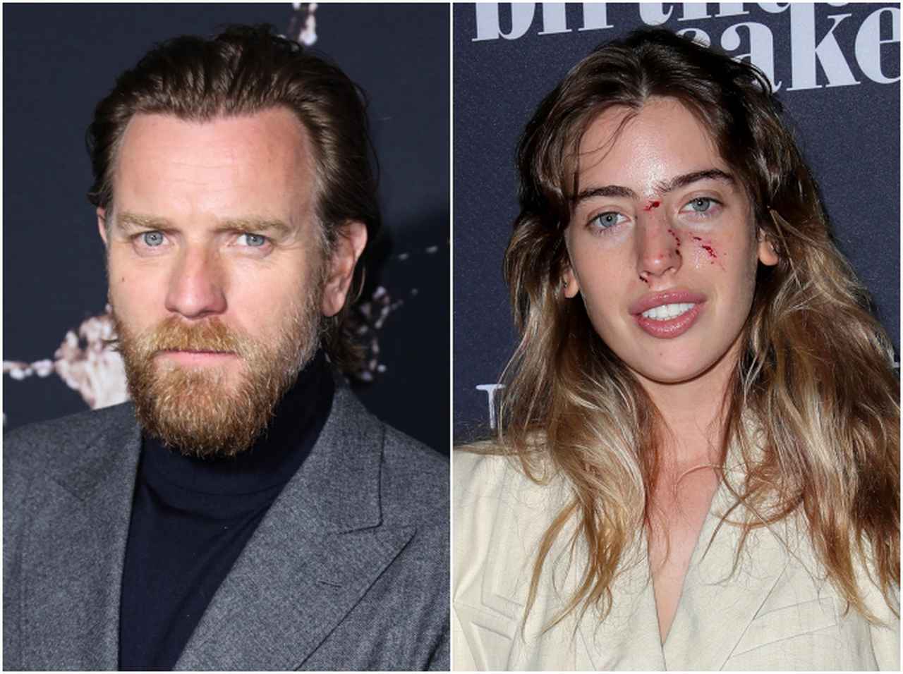 ユアン・マクレガー娘、犬に顔面噛まれても父出演作のプレミアに登場するド根性ぶり