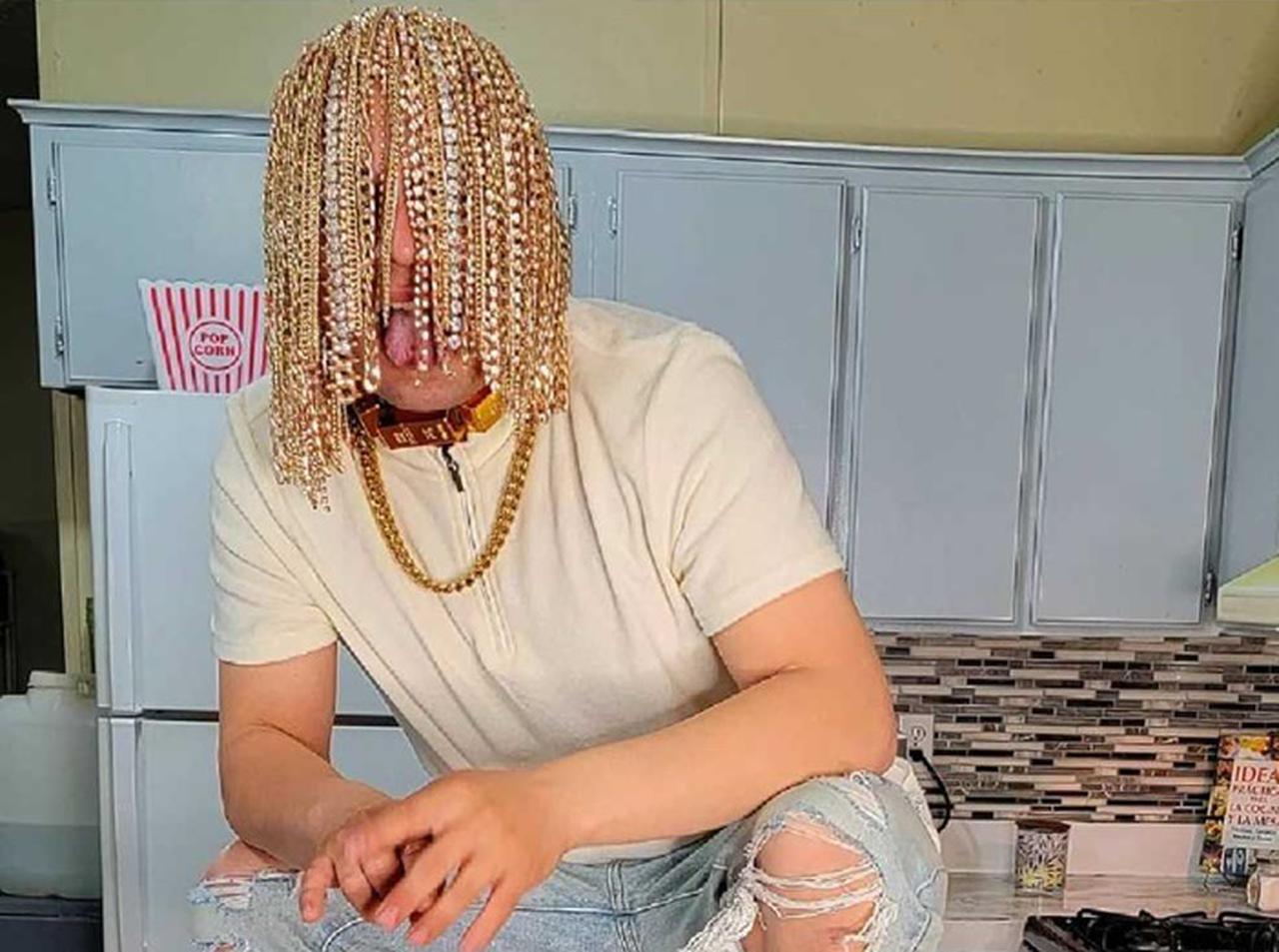 頭に金のチェーンを手術で埋め込み「髪の毛風」に、メキシコ人ラッパーが強烈