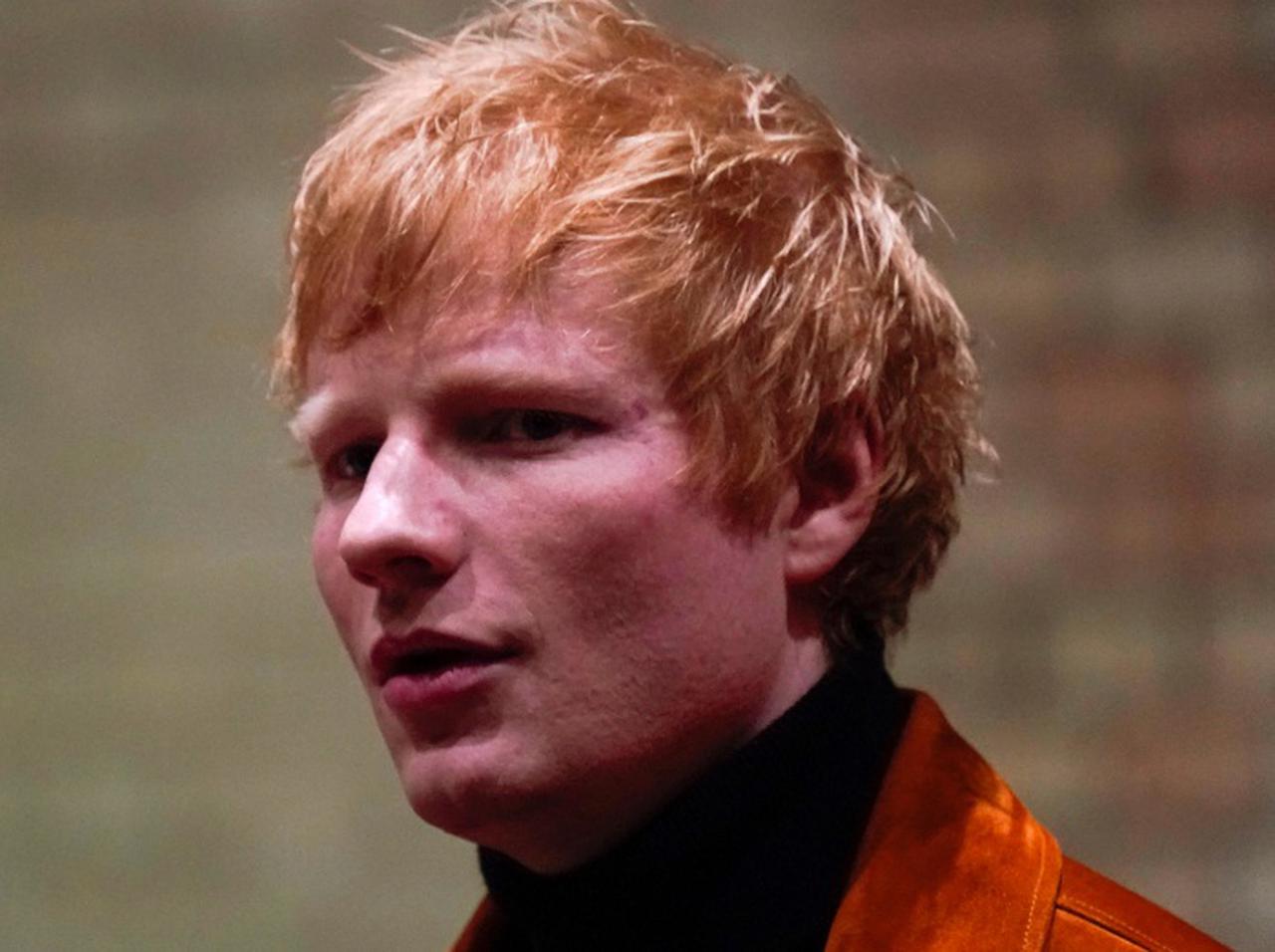 エド・シーラン、新型コロナウイルスの陽性になったことを報告