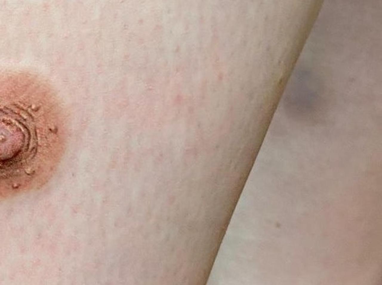 乳首タトゥーを入れたら「人間が出来ている」と言われた理由に感動