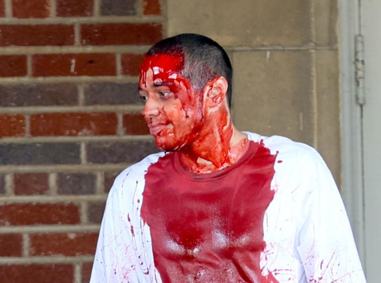 ピート・デヴィッドソンが血まみれ、何が起こった?