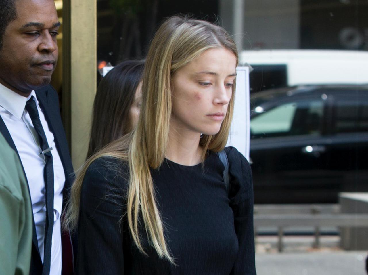 ジョニー・デップ元妻がDVによる「顔のアザ」を隠すために使ったと主張のコスメ、未発売だった