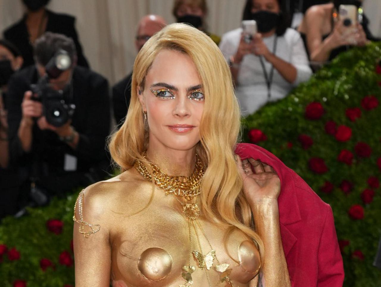 半裸で登場のカーラ・デルヴィーニュ、メットガラで「乾癬」をあえて見せていた