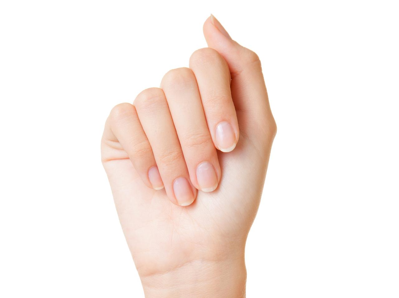 爪に白い斑点ができるのはなぜ?皮膚科医が教えるその原因と予防法