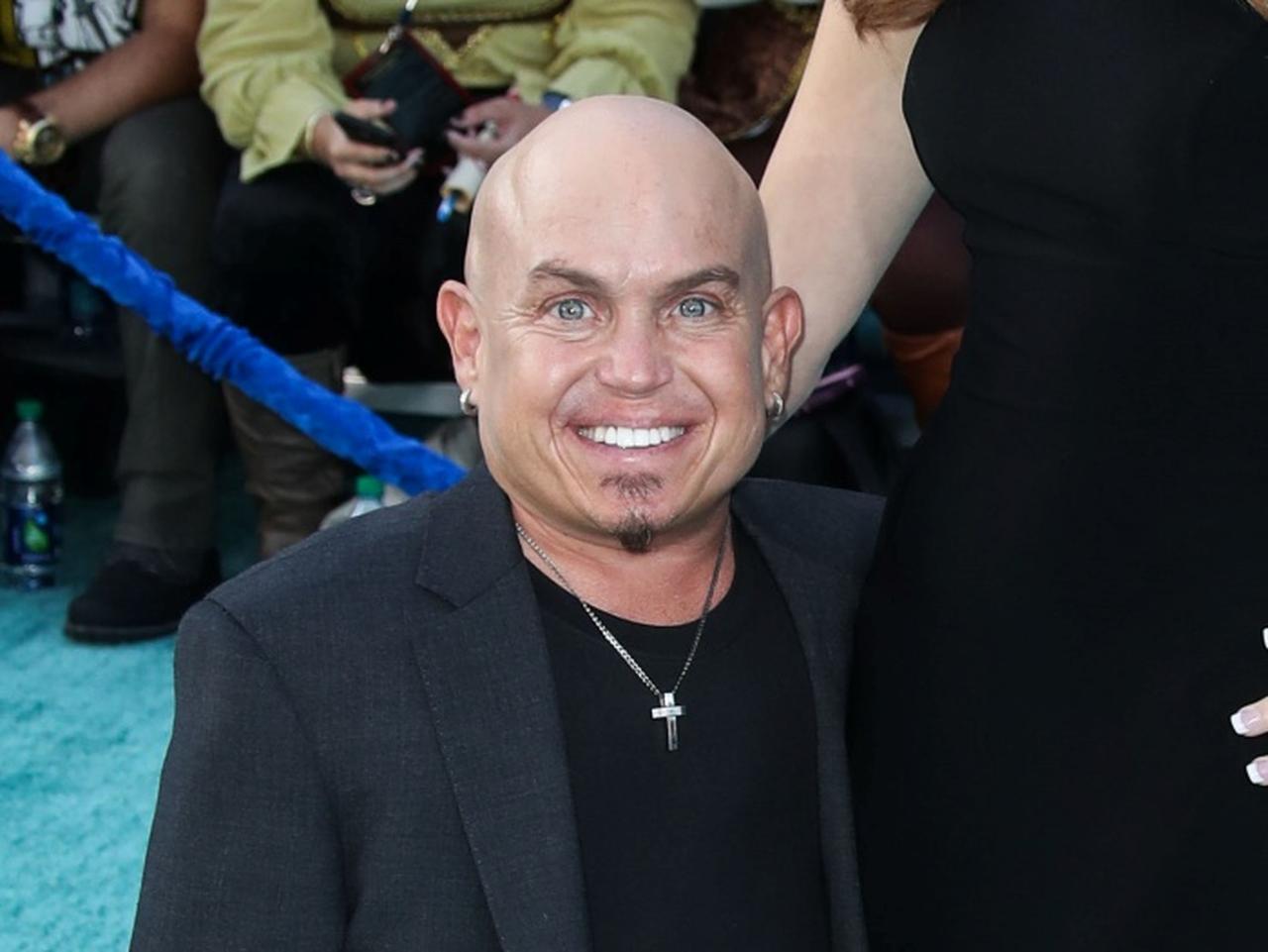 実写版『白雪姫』おこりんぼう役に小人症俳優を起用、7人の小人の描かれ方に様々な意見が