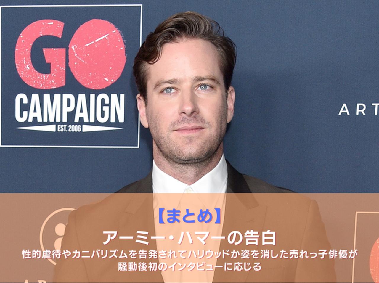 性的虐待やカニバリズムを告発されてハリウッドから消えたアーミー・ハマー、レイプ疑惑を改めて否定