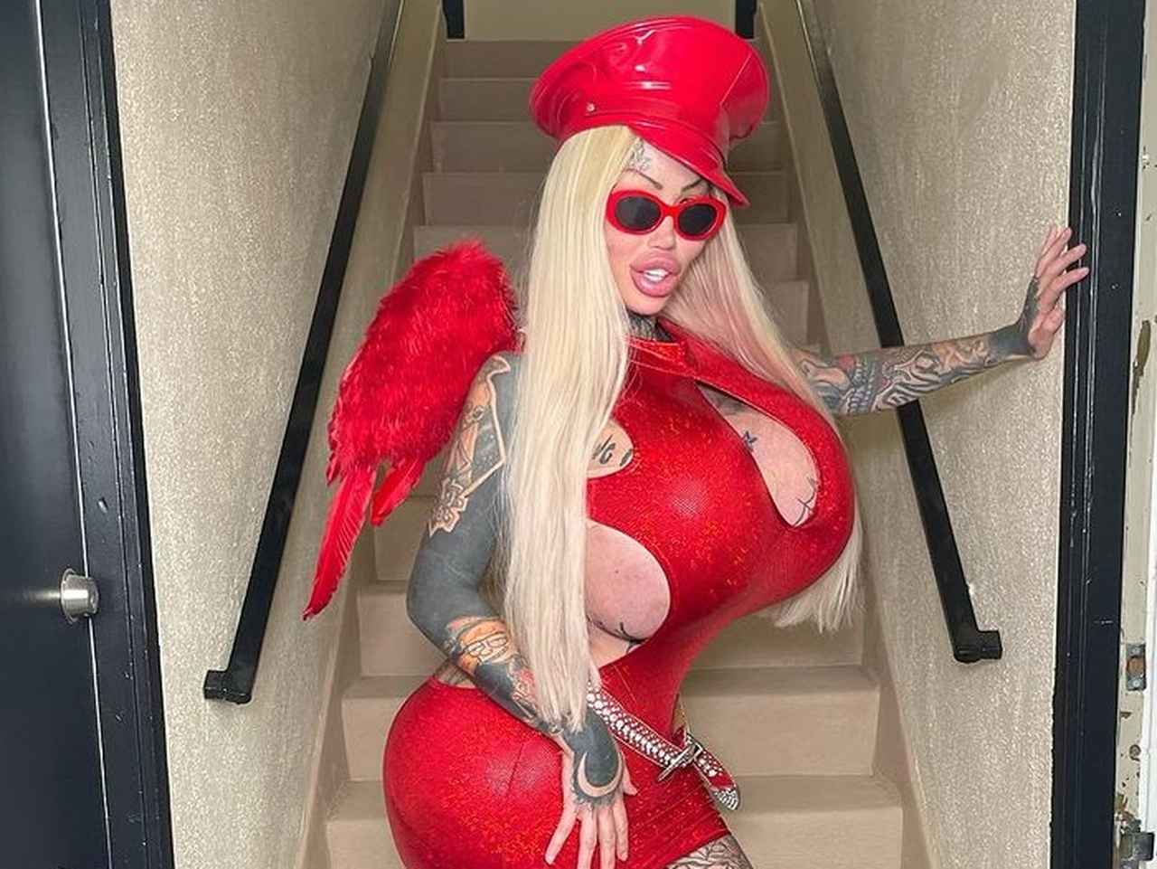 豊胸手術で10キロの胸を持つ女性、5000ccのインプラントが「ポン」と音立て破裂