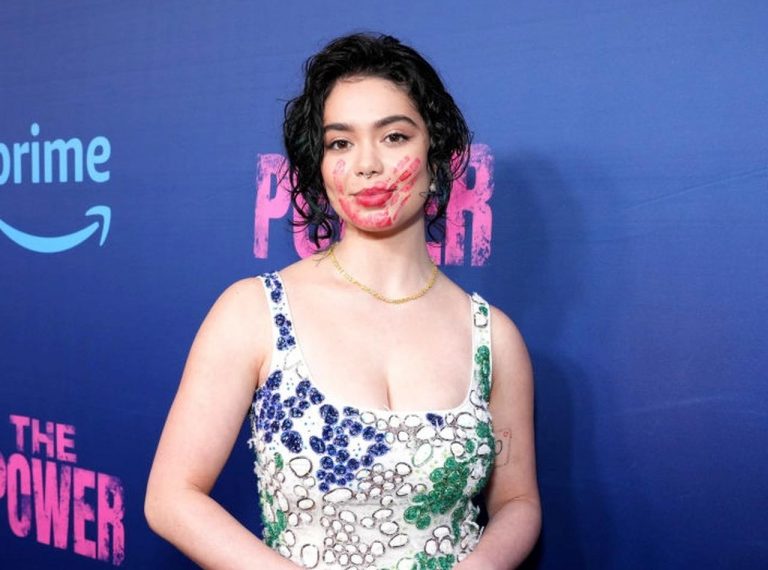 モアナ役アウリィ・カルバーリョ、顔面に“ビンタの跡”があった理由は？