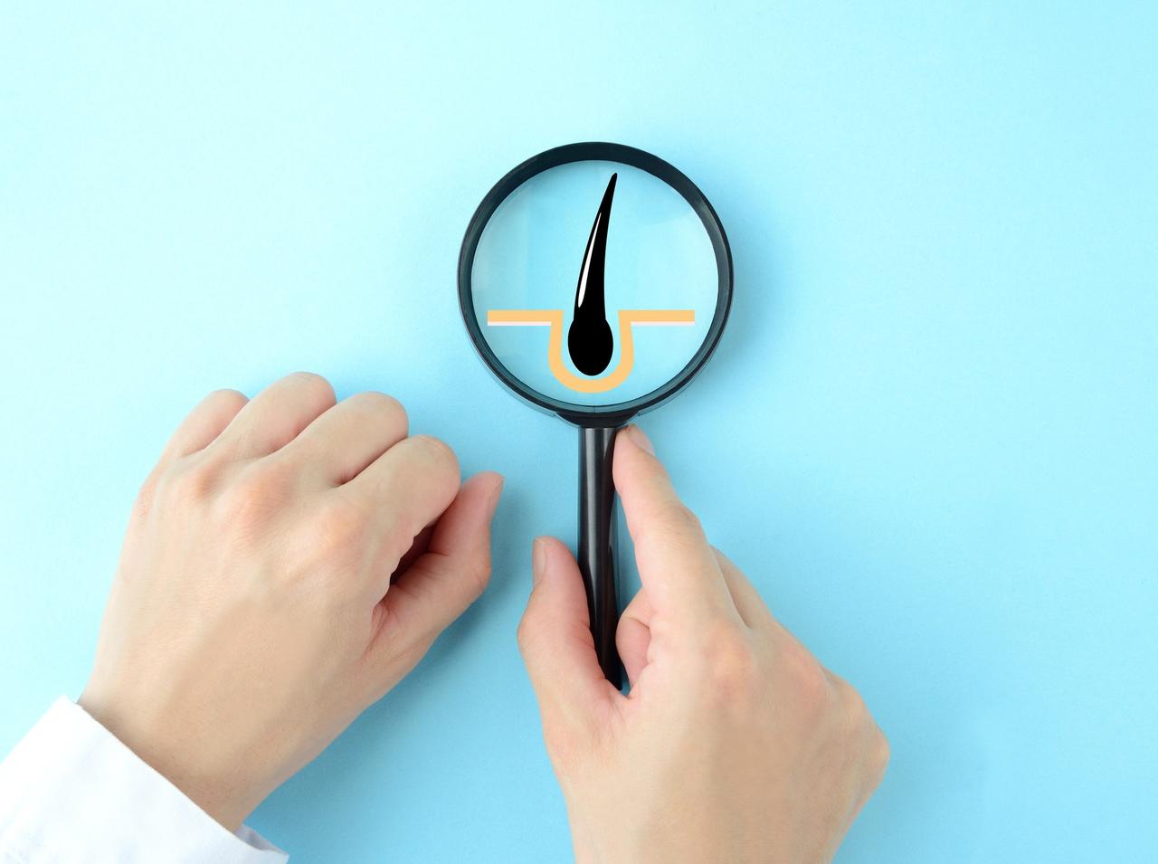 白髪がいつも同じ場所から生えてくる…！よくある白髪の疑問を専門家が解説