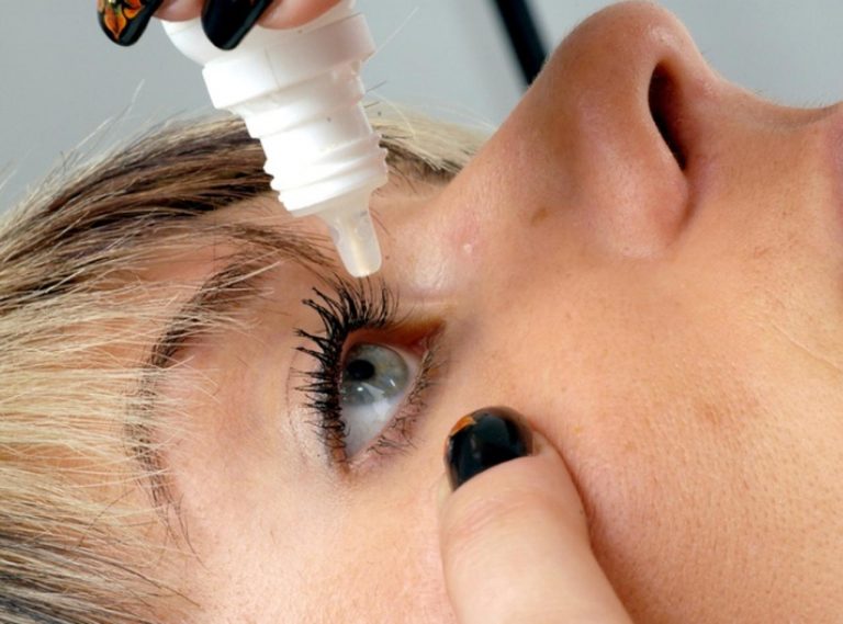 目薬と間違えて目に「瞬間接着剤」を点眼した結果が悲惨