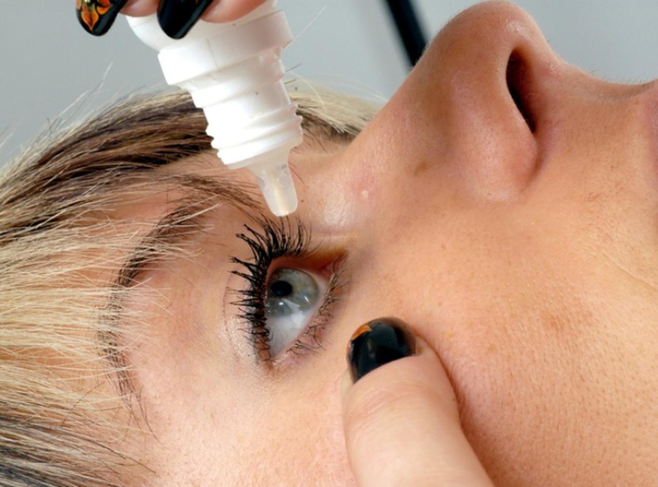 目薬と間違えて目に「瞬間接着剤」を点眼した結果が悲惨