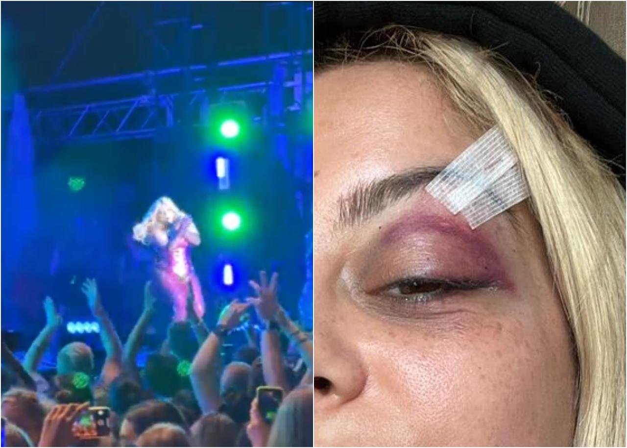 【衝撃映像の続報】顔面強打後の傷を公開、犯人は『呆れた動機』を語る