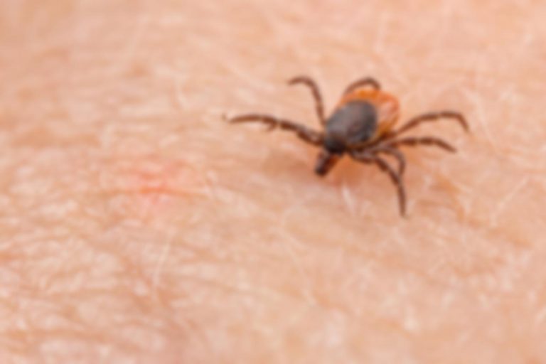 ダニに噛まれた数週間後に体に悲劇…「食べ物が敵になってしまった」