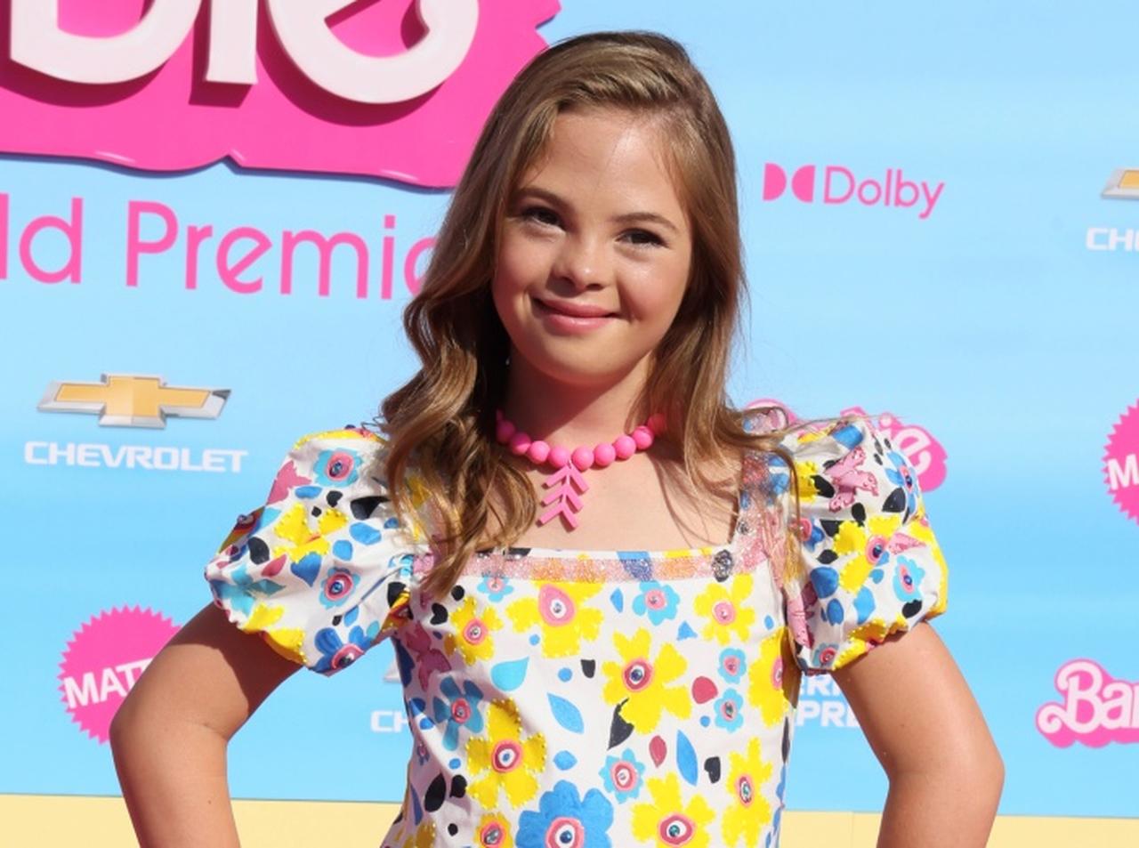 ダウン症モデルが『バービー』のプレミアで着用した衣装には秘密が