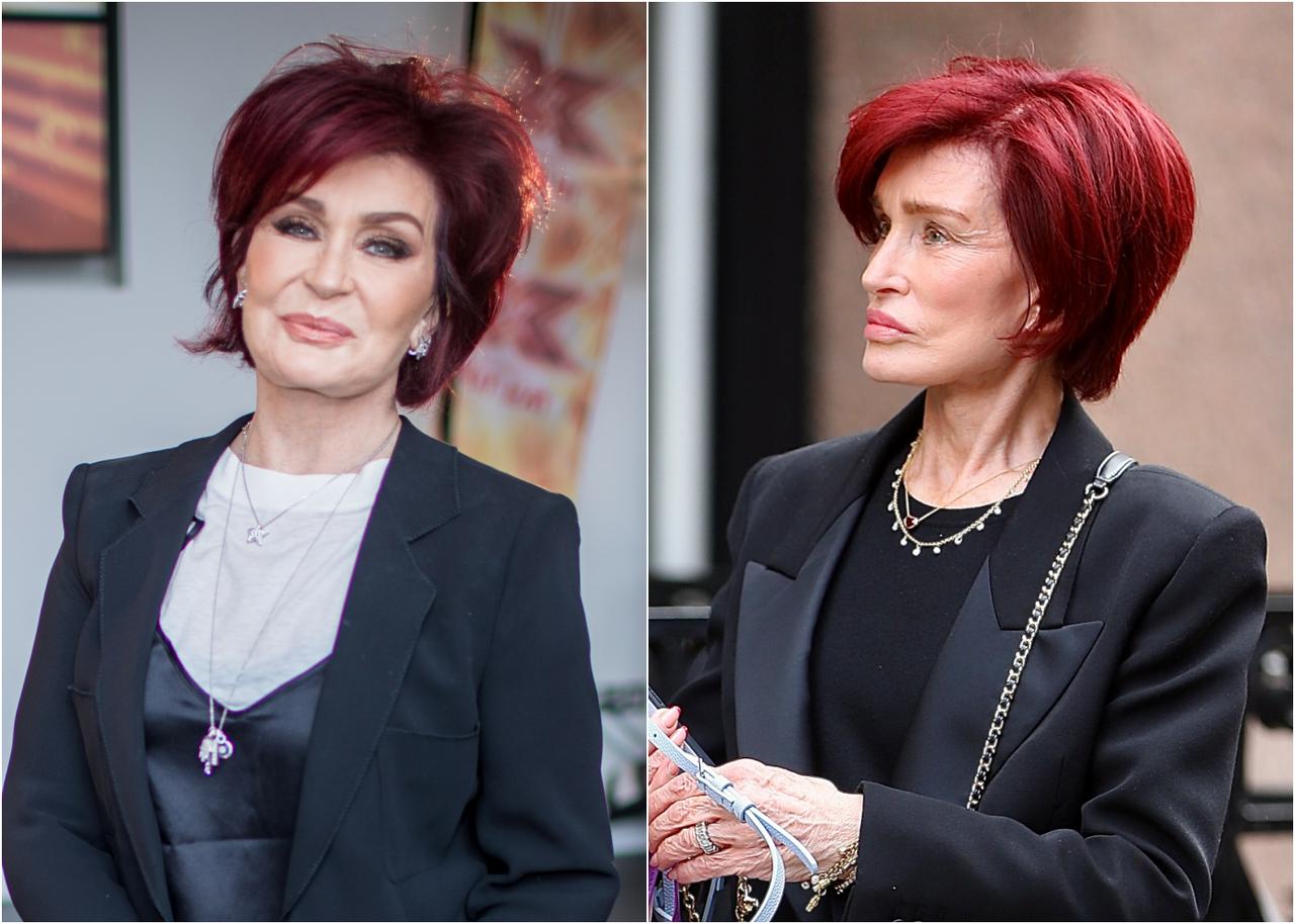 19キロ激やせ…減量で話題の「オゼンピック」接種セレブが危険性を語る