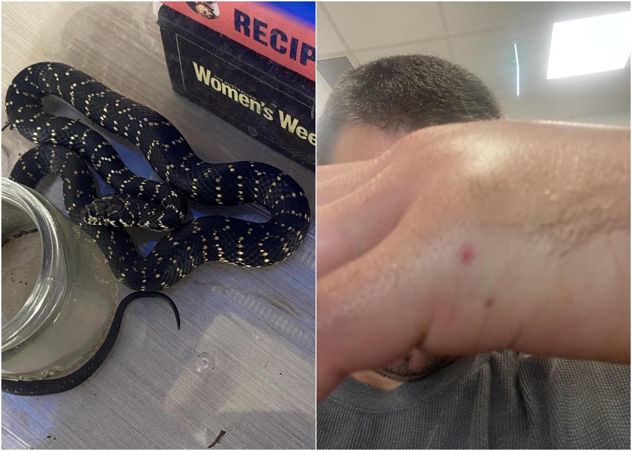 ヘビを子どもに見せようと持ち帰った男性、噛まれて緊急搬送