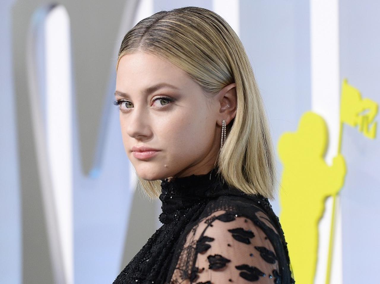 リリ・ラインハートが「脱毛症」と診断されたことを告白