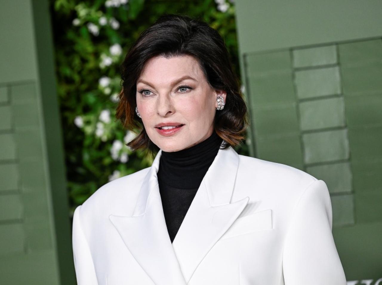 整形失敗の元祖スーパーモデル、欠点ごと自分を愛そうと決心