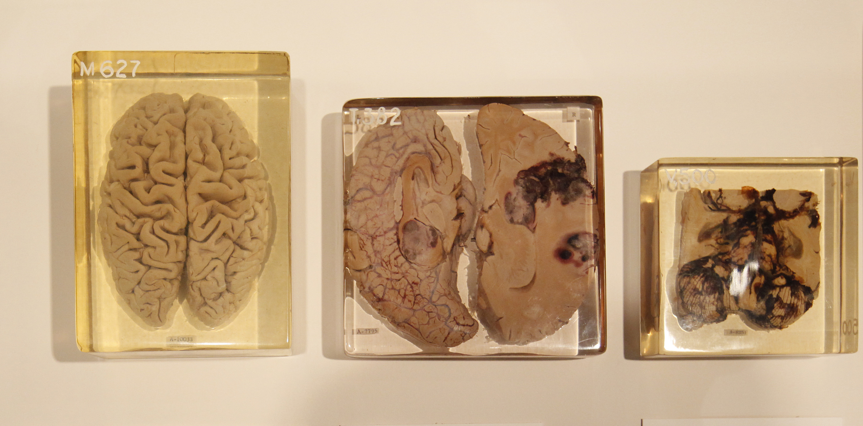 脳の老化の7割は「腸」で決まる？専門家が明かすNG習慣5つ