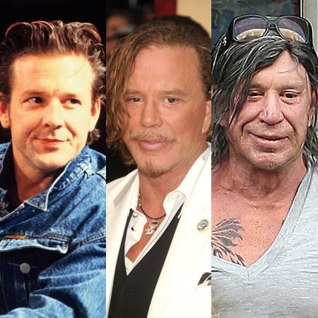 ミッキー・ローク　Mickey Rourke　整形　顔の変化