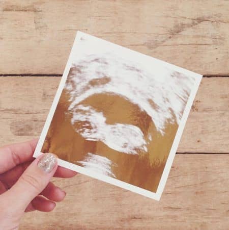 ローレン・コンラッド　Lauren Conrad　妊娠　エコー写真　ベビー