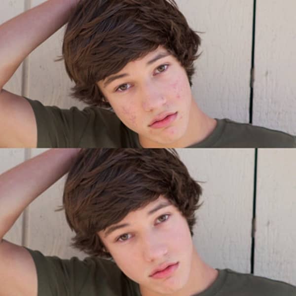 キャメロン・ダラス　Cameron Dallas ツイッター写真　ニキビ