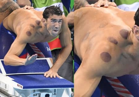 マイケル・フェルプス　Michael Phelps　オリンピック選手　水泳　カッピング